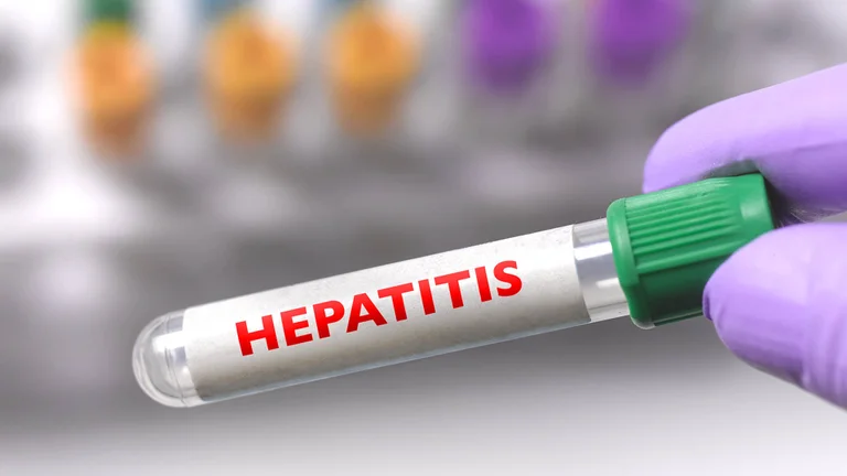 Hepatitis de origen desconocido en niños: hay alerta en América Latina B3VZEJ2FHNH3XHABWLCGAWL4WI