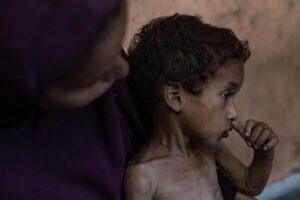 La desnutrición mata a cinco gazatíes, incluido un bebe y 2 niños, en las últimas 24 horas