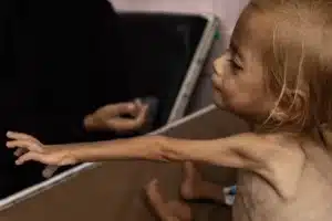 Los muertos por desnutrición en Gaza superan ya los 250