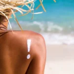 Calor-eleva-el-riesgo-de-danos-en-la-piel-como-protegerte
