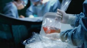 CENATRA coordina con éxito el traslado de órganos de forma simultánea en distintas regiones del país